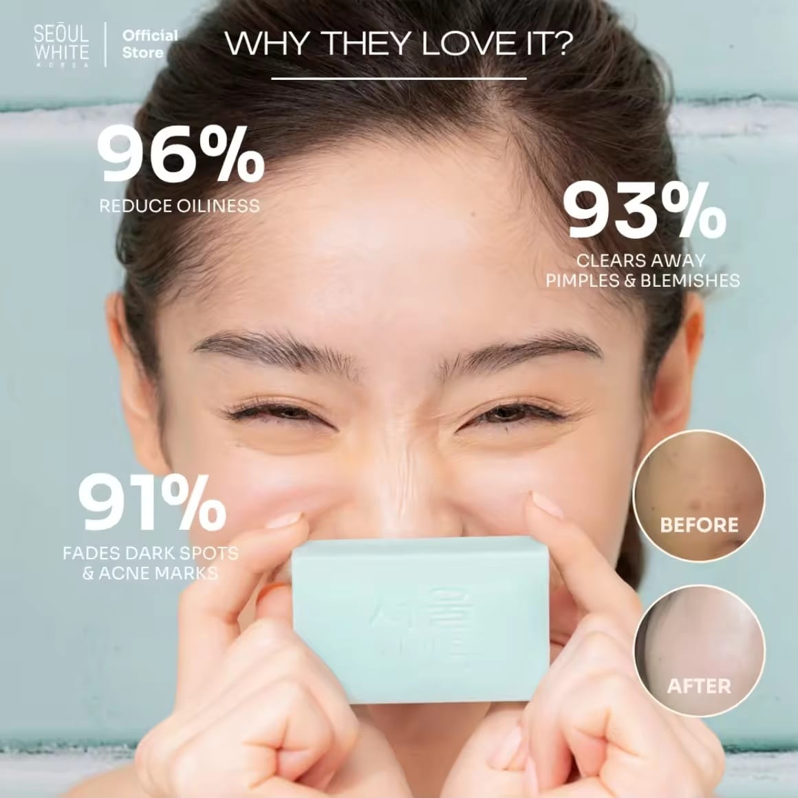 Seoul White Bye Bye Acne Soap 60g x2 | Savon Purifiant Anti-Imperfections – Lot de 2