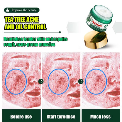 Acnè Oil Control Tea Tree Cream 50 g – Soin Visage Purifiant & Contrôle du Sébum