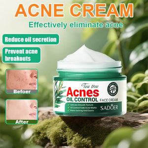 Acnè Oil Control Tea Tree Cream 50 g – Soin Visage Purifiant & Contrôle du Sébum