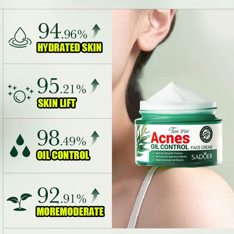 Acnè Oil Control Tea Tree Cream 50 g – Soin Visage Purifiant & Contrôle du Sébum
