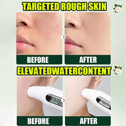 Acnè Oil Control Tea Tree Cream 50 g – Soin Visage Purifiant & Contrôle du Sébum