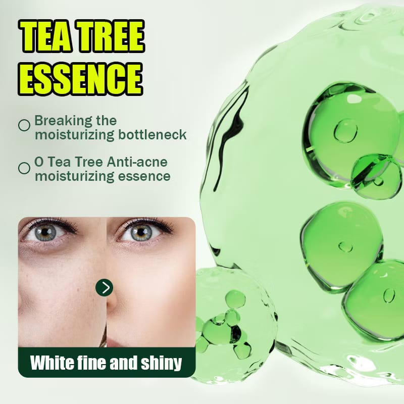 Acnè Oil Control Tea Tree Cream 50 g – Soin Visage Purifiant & Contrôle du Sébum