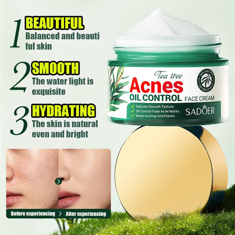Acnè Oil Control Tea Tree Cream 50 g – Soin Visage Purifiant & Contrôle du Sébum