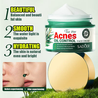 Acnè Oil Control Tea Tree Cream 50 g – Soin Visage Purifiant & Contrôle du Sébum