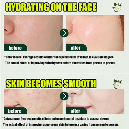 Acnè Oil Control Tea Tree Cream 50 g – Soin Visage Purifiant & Contrôle du Sébum