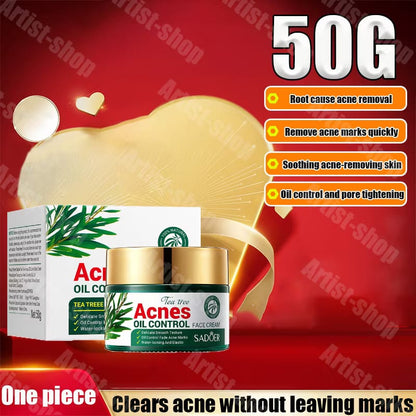Acnè Oil Control Tea Tree Cream 50 g – Soin Visage Purifiant & Contrôle du Sébum