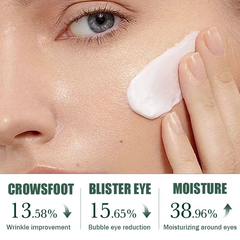 Acnè Oil Control Tea Tree Cream 50 g – Soin Visage Purifiant & Contrôle du Sébum