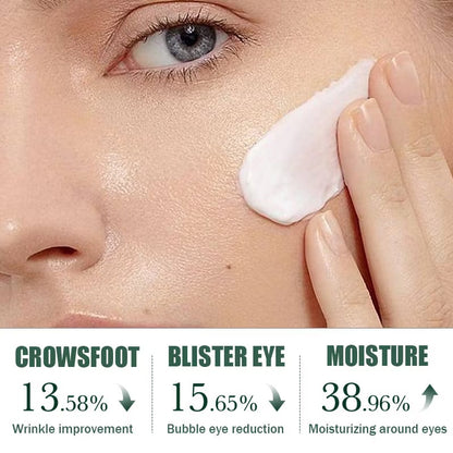 Acnè Oil Control Tea Tree Cream 50 g – Soin Visage Purifiant & Contrôle du Sébum